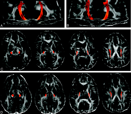 Fig 14.