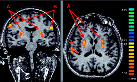   Fig 1. 