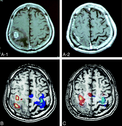 Fig 2.