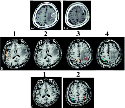 Fig 3.