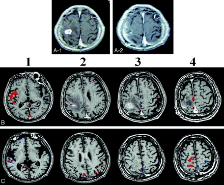 Fig 5.
