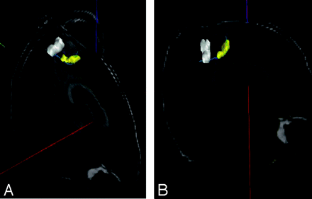 Fig 6.