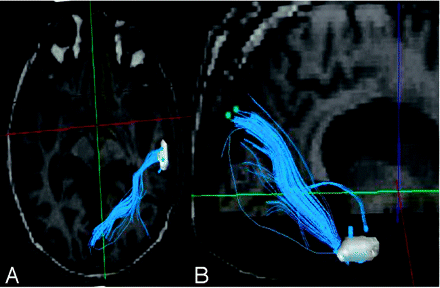 Fig 7.