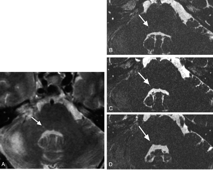 Fig 2.