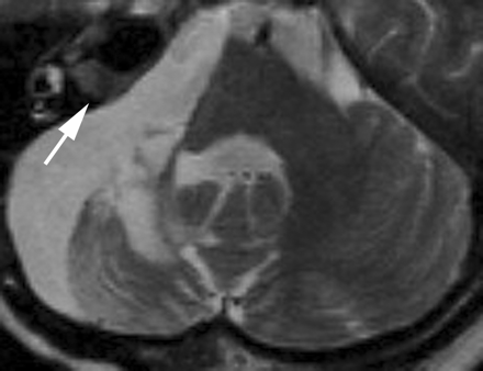 Fig 4.