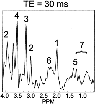 Fig 2.