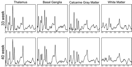 Fig 3.