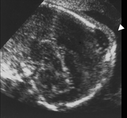 Fig 1.