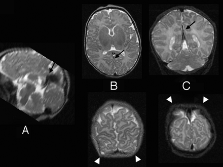 Fig 2.