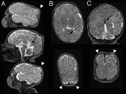 Fig 3.