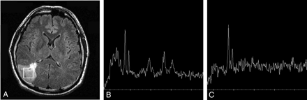 Fig 3.