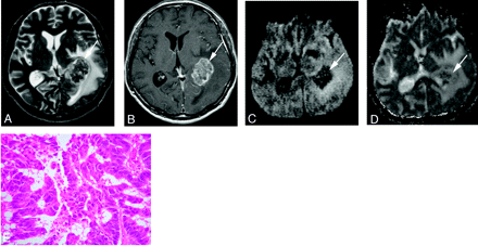 Fig 2.