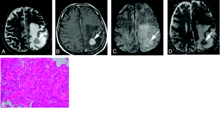 Fig 3.