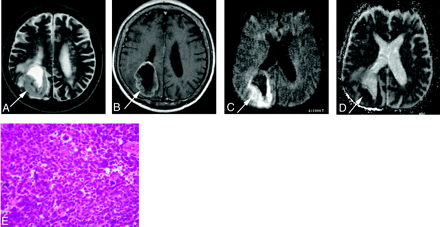 Fig 4.