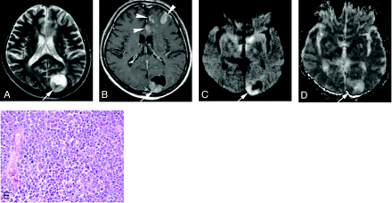 Fig 5.