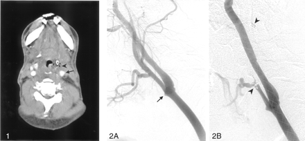 Fig 2.