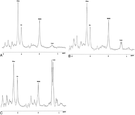 Fig 2.