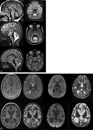 Fig 1.