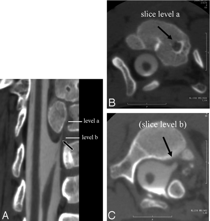 Fig 3.