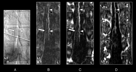 Fig 4.