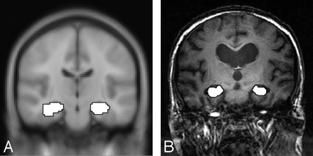 Fig 1.
