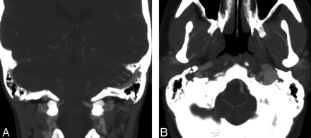 Fig 1.