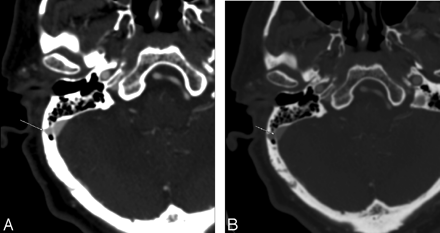 Fig 2.