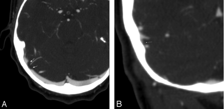 Fig 3.
