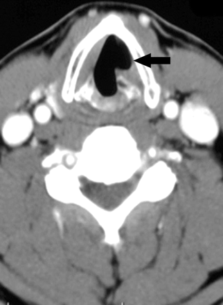 Fig 1.