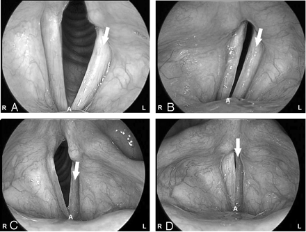 Fig 2.