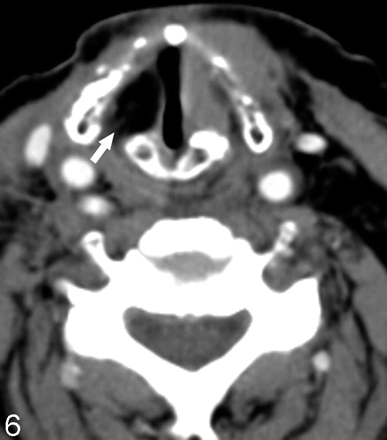 Fig 6.