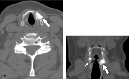 Fig 7.