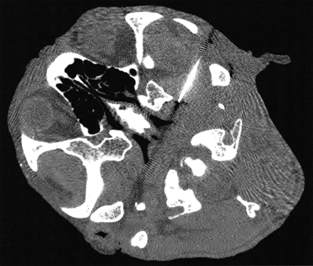 Fig 2.