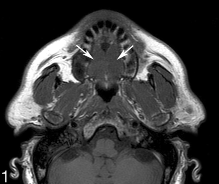 Fig 1.
