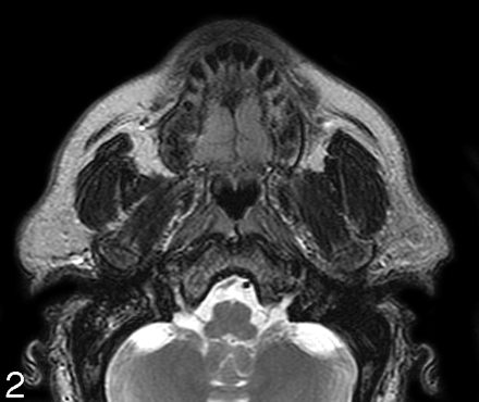 Fig 2.