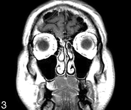Fig 3.