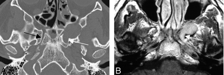 Fig 2.