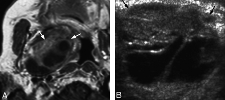 Fig 2.
