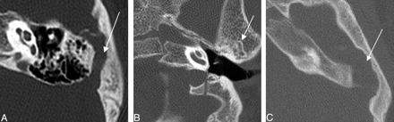 Fig. 11.