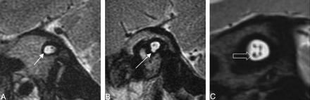 Fig. 12.