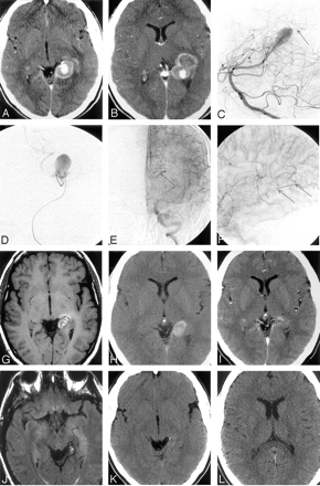 Fig 2.