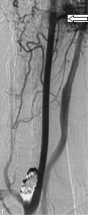 Fig 1.
