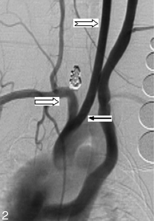 Fig 2.