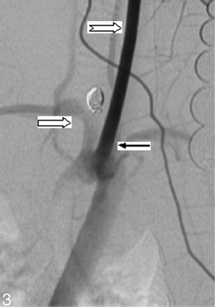 Fig 3.