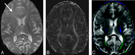 Fig 3.