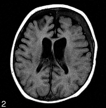 Fig 2.