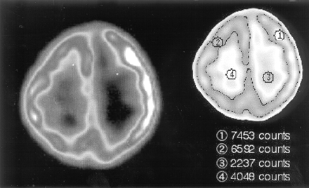 Fig 2.