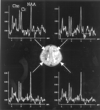 Fig 3.