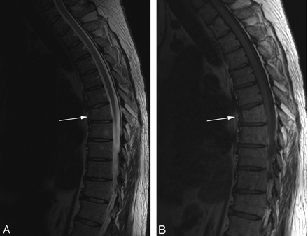 Fig 2.