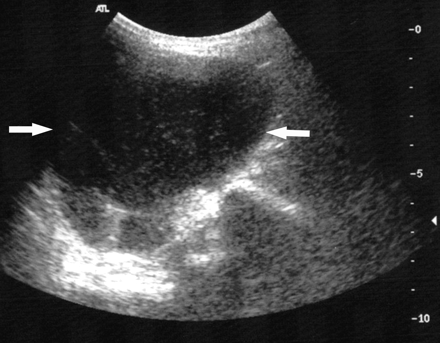 Fig 1.